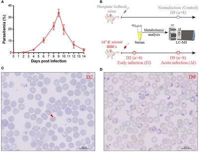 Serum metabolomic profiles in BALB/c mice induced by Babesia microti infection